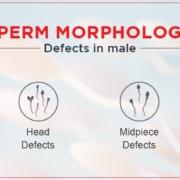 sperm morphology treatment