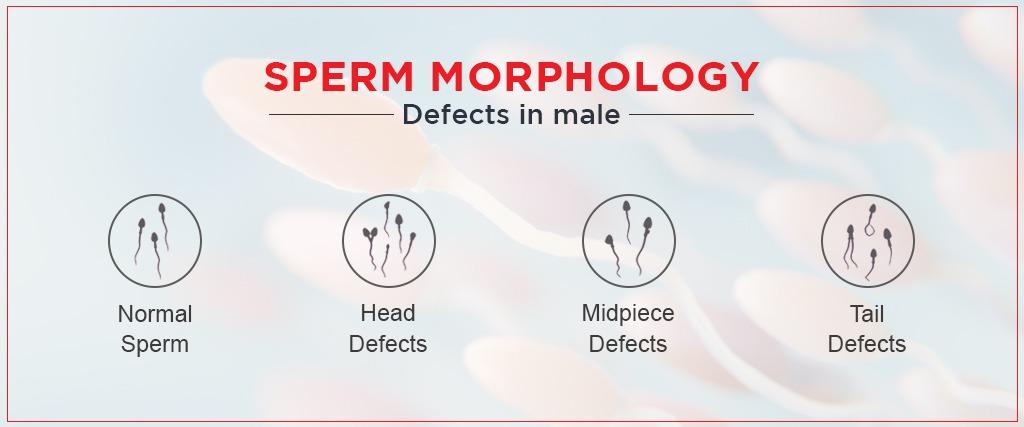 sperm morphology treatment