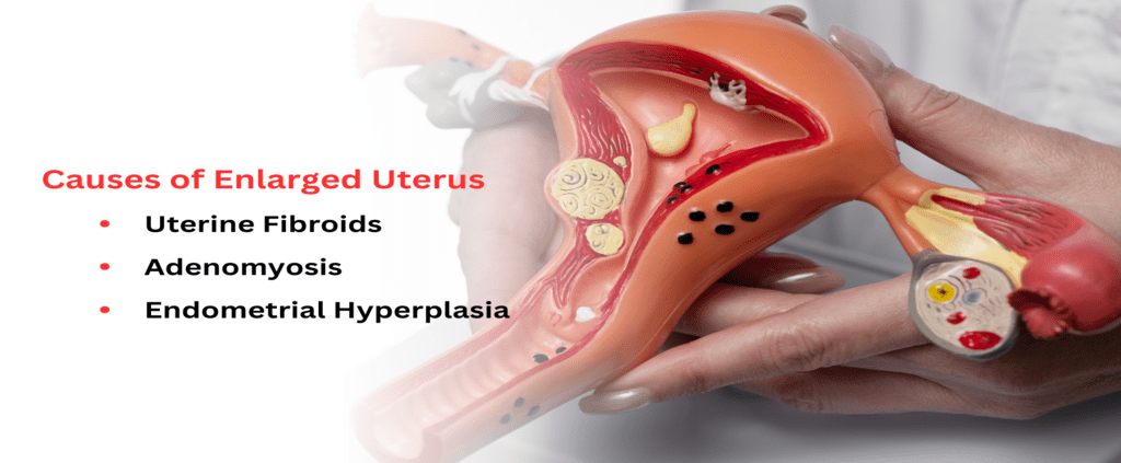 Causes of Enlarged Uterus