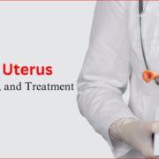 Enlarged Uterus