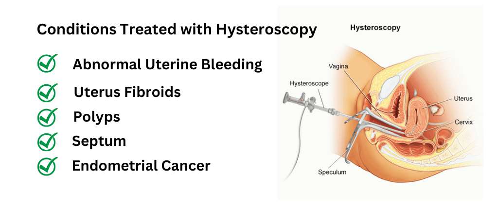 Conditions Treated with Hysteroscopy