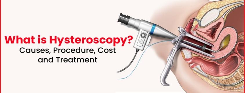 Hysteroscopy
