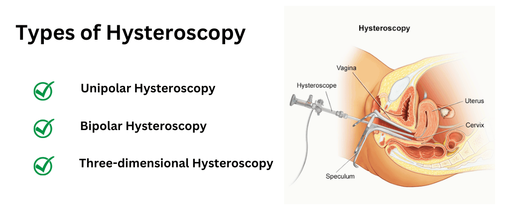 Types of Hysteroscopy