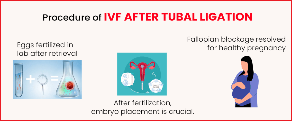 IVF Procedure after Tubal Ligation
