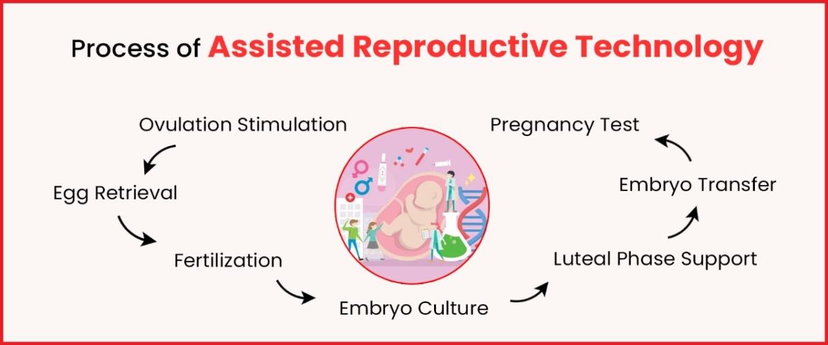 Process of Assisted Reproductive Technology
