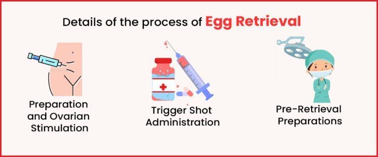 Egg Retrieval Procedure Step by Step Imprimis IVF Centre Egg Retrieval Procedure Step by Step Imprimis IVF Centre