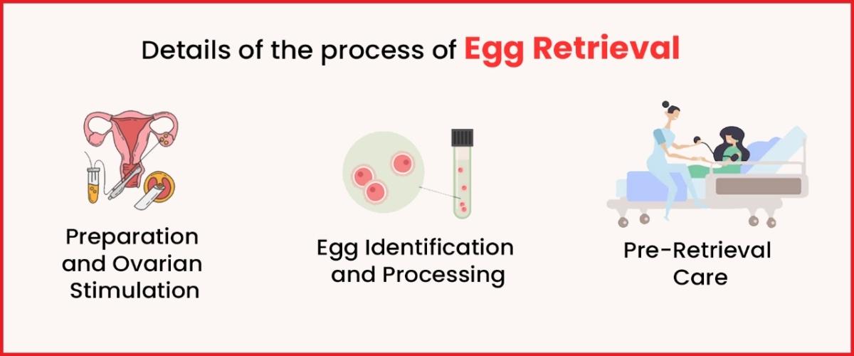 Process of Egg retrieval