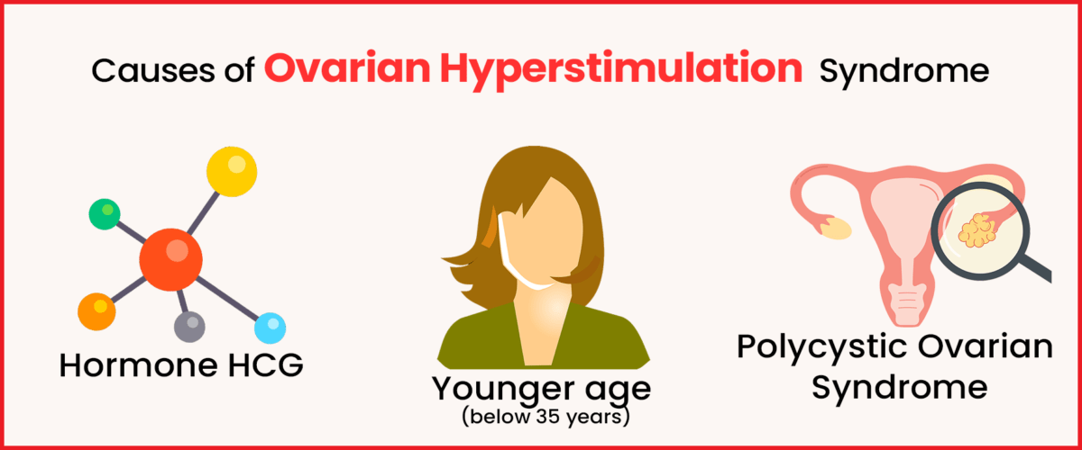 Causes of Ovarian Hyperstimulation Syndrome