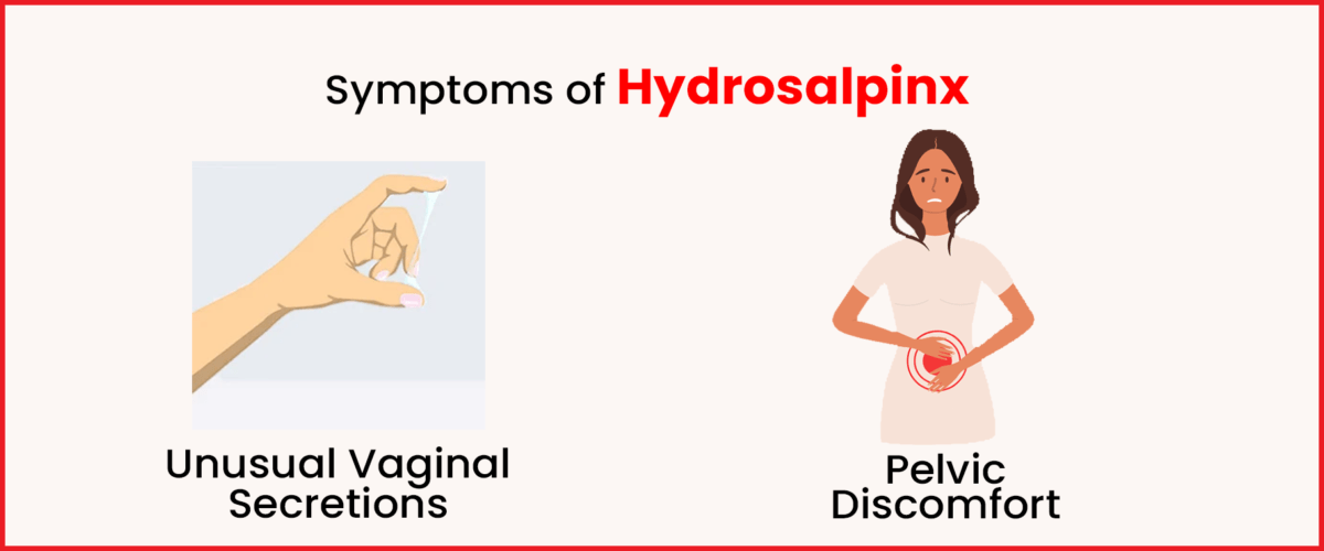 Symptoms of Hydrosalpinx