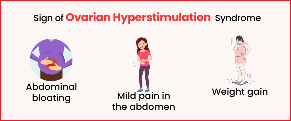 Symptoms of Ovarian Hyperstimulation Syndrome