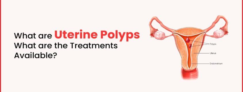 Uterine Polyps