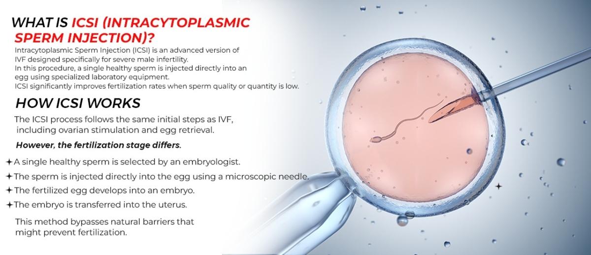 What is ICSI - Infertility Treatments
