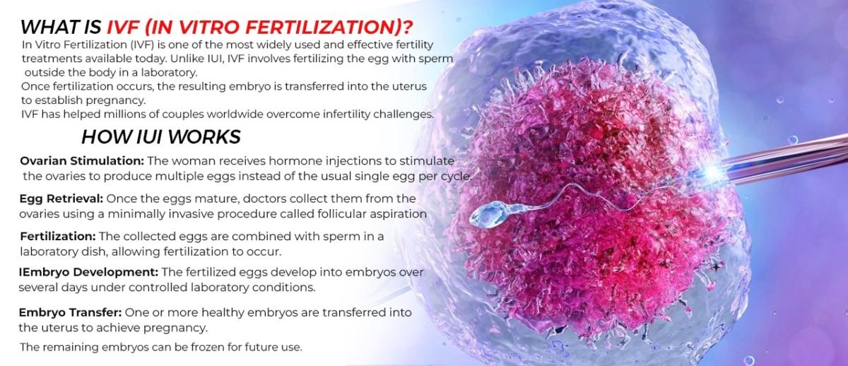 What is IVF - Infertility Treatments