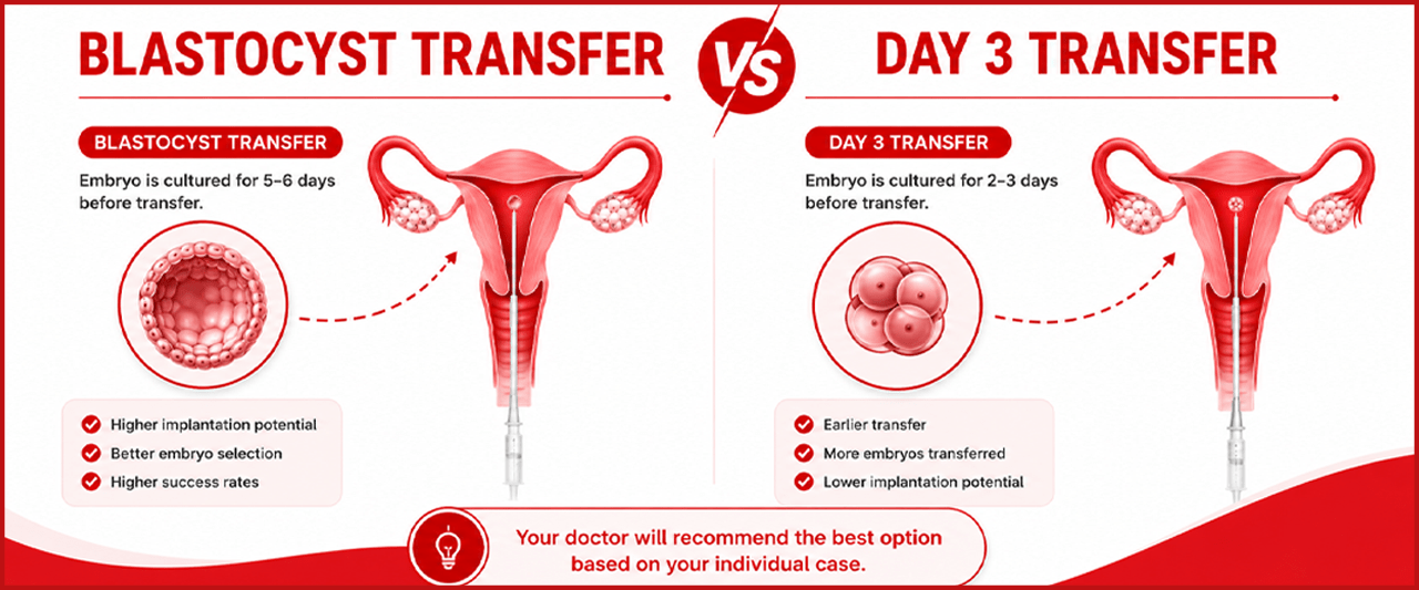 Day 3 vs Day 5 Embryo Transfer: Which Is Better in IVF?